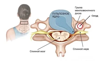 Центр лечения позвоночника и суставов на Волковской улице изображение 4